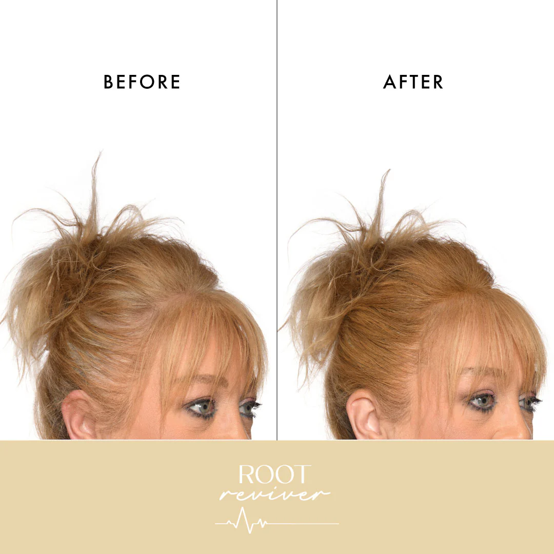 'Root Reviver' - Root Touch Up Spray - Image 10