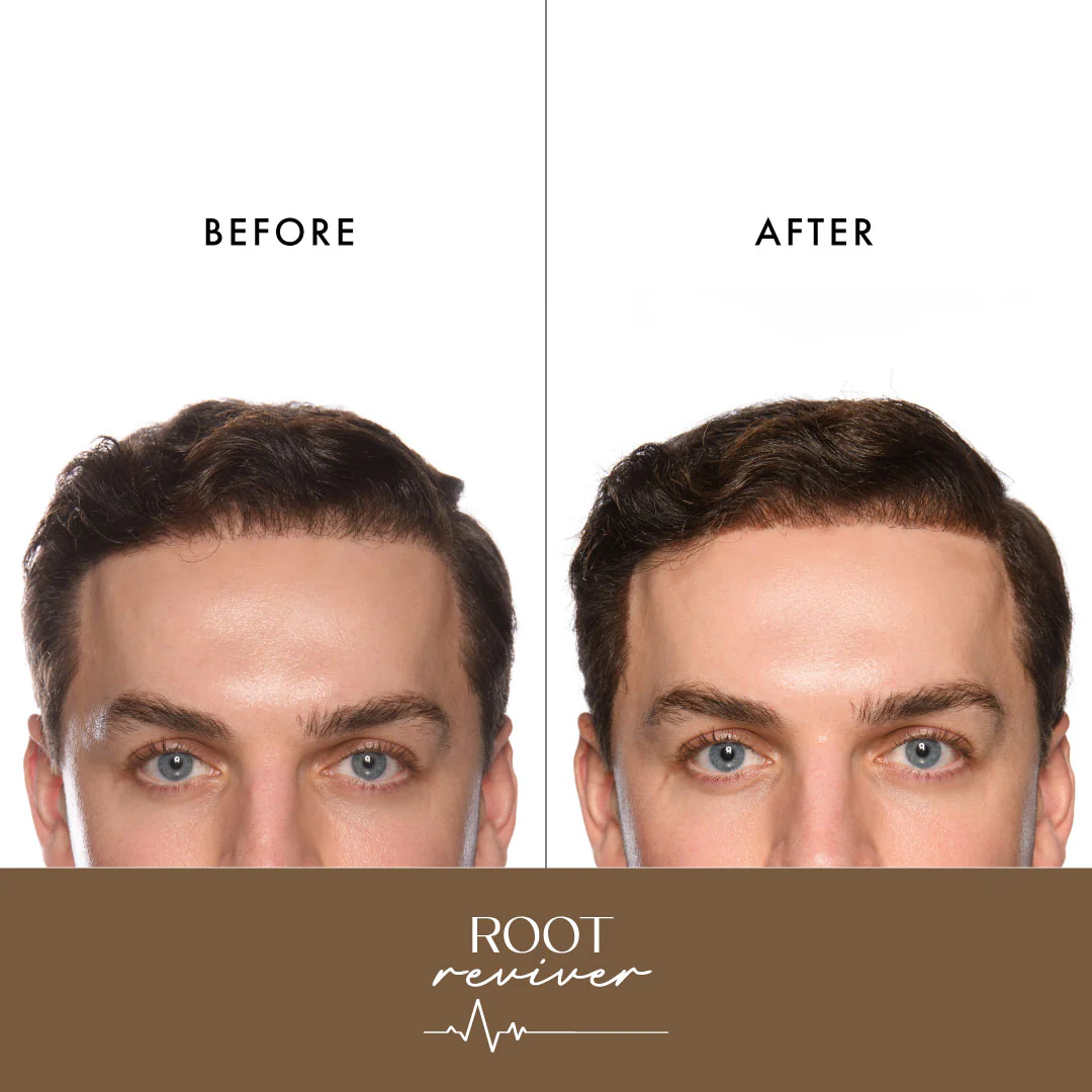 'Root Reviver' - Root Touch Up Spray - Image 6