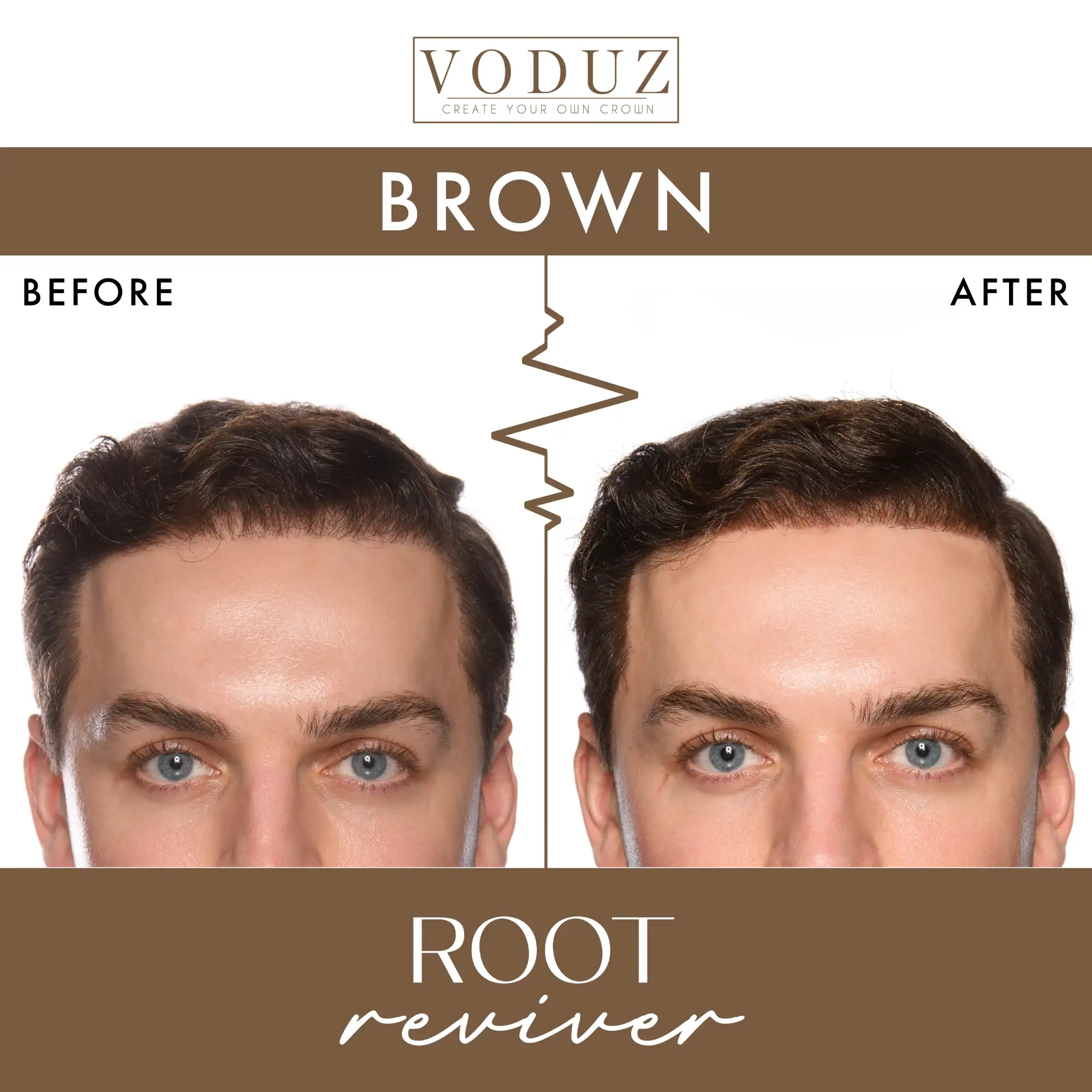 The Root Rescue - Root Touch-Up Bundle - Image 9